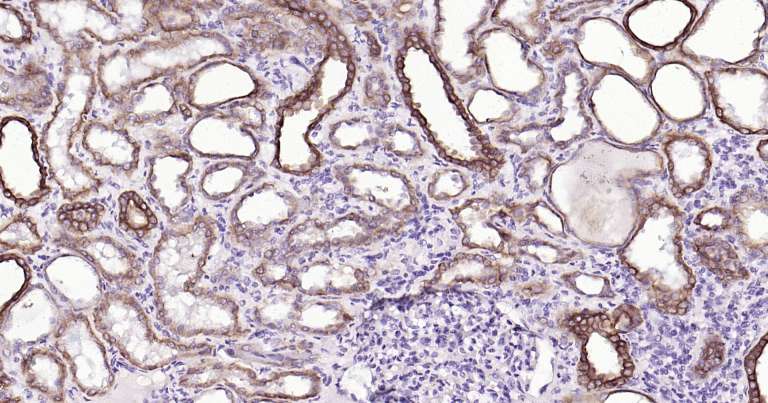 人细胞角蛋白18即用型免疫组化试剂盒-IHC0249H